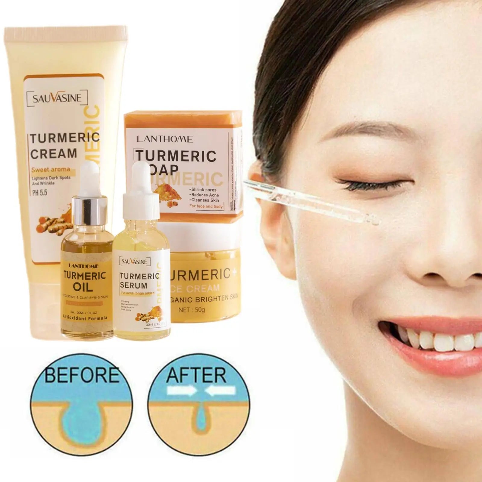 5 Piece Set Turmeric Facial Care Acne Cleansing Cream,Anti-Aging Serum,Dark spot Moisturizer Fade Spots for Radiant Skin Care
